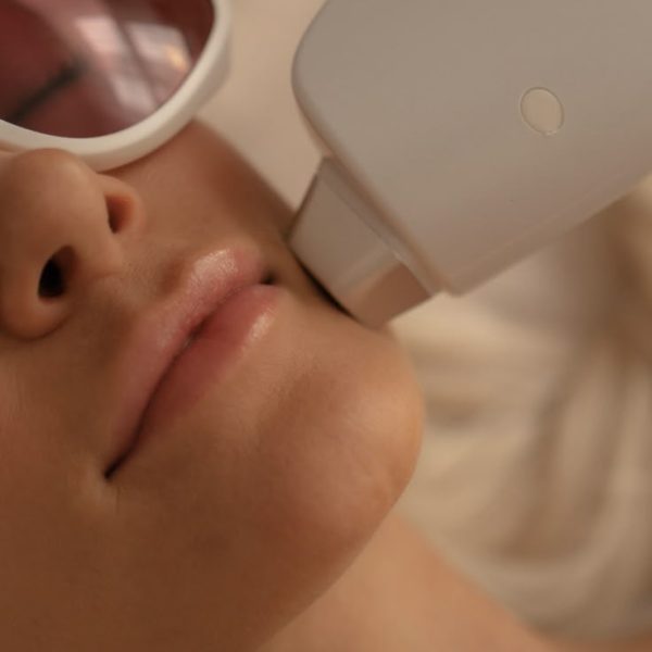 ZA PAKET 6+1 GRATIS LASER
